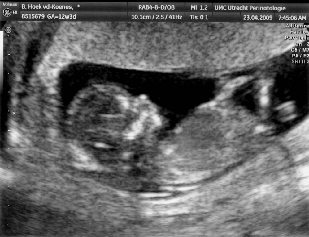 Click to see next photo